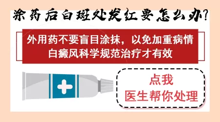 白斑用药后偶尔刺痛灼热正常吗