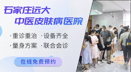 石家庄治疗白癜风效果好的医院排名