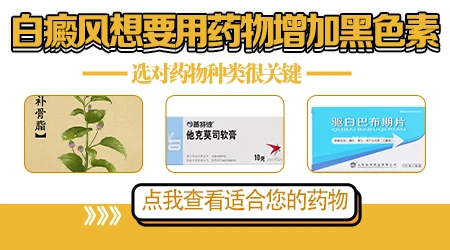 早期白癜风只用外用药膏够不够 需要照光吗