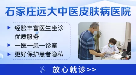 石家庄看白癜风去哪家医院