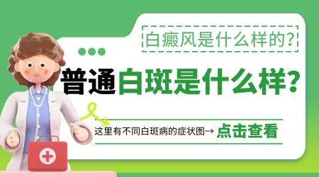 脸上白癜风刚长来什么样子图片