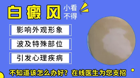 儿童脸上白斑是怎么回事 家长必看的鉴别诊断指南