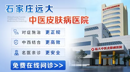 石家庄哪家白癜风医院复发率低