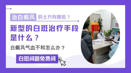 白癜风土方法可以治好吗