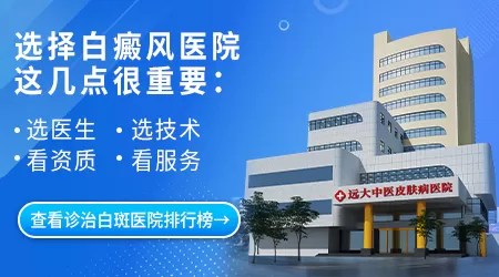 石家庄治疗白癜风医院推荐排名