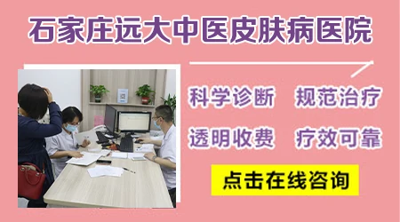 肛周白斑的初期症状图片