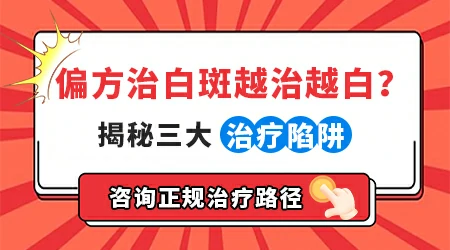 白癜风久治不愈用偏方靠谱吗