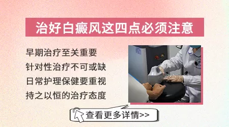 白癜风目前可以治好吗