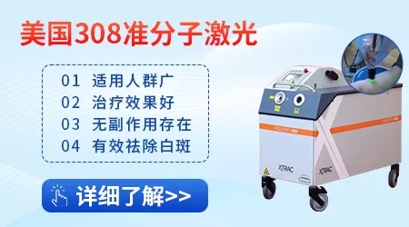 白癜风照308nm准分子激光价格多少