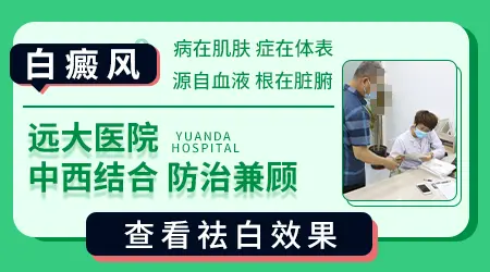 儿童早期白癜风能不能治愈