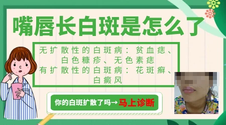 嘴角边上有白斑图片 什么原因引起的