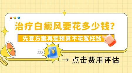白癜风注射黑色素价格大概多少