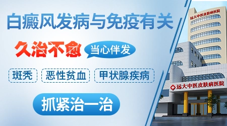 自身免疫缺陷引起白斑怎么治疗
