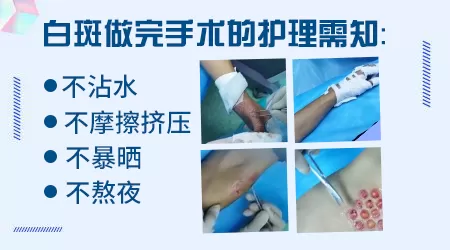 白癜风做表皮移植手术有什么风险