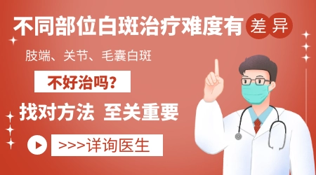 手部白癜风为什么难治 有什么特殊治疗方法