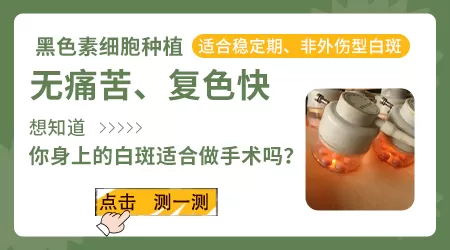 白癜风种植黑色素细胞恢复的概率高不高