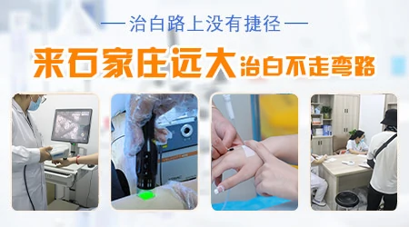 白癜风和各类白斑的区别汇总图片