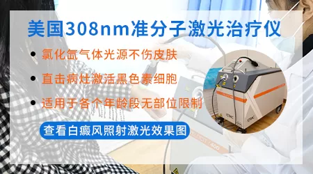 美国308激光照白癜风效果怎么样