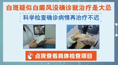 医生没确诊只说疑似白癜风怎么办