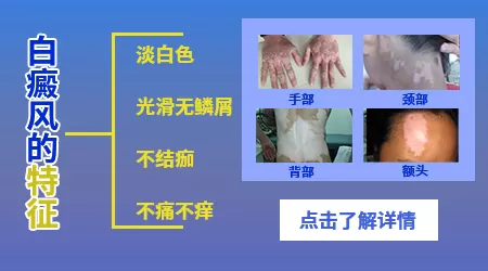 手臂上有小白点不痛不痒是什么