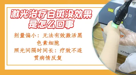 白癜风照308激光开始红后来没反应怎么回事