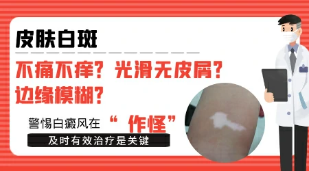 皮肤变白一块不痛不痒是什么