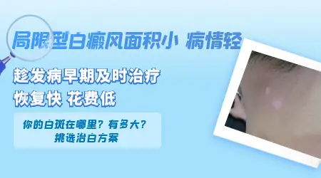 局限型白癜风需要光疗吗