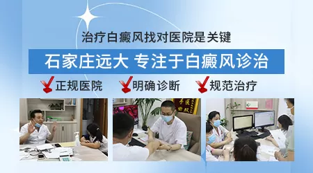 白癜风白斑从淡白色变成乳白色是严重了吗