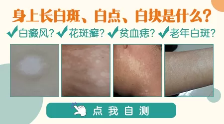 身上出现一小块块的白是怎么回事