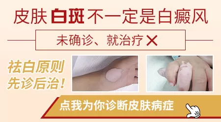 身上出现一小块块的白是怎么回事