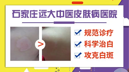 身上出现一小块块的白是怎么回事