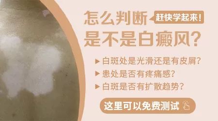 日晒后白斑发红是白癜风吗