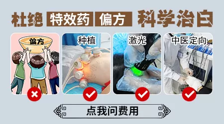 治疗白癜风的偏方有用吗