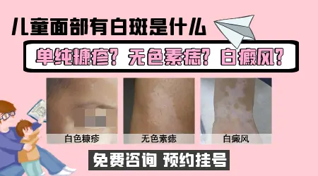 两周岁的小孩脸上出现白斑怎么回事