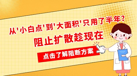 白癜风的白斑会融合成大片吗