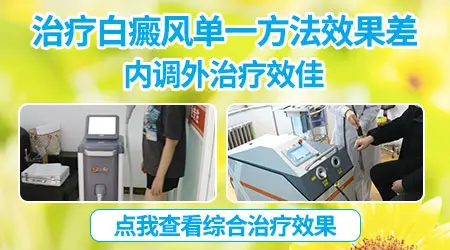白癜风涂药还需要配合光疗吗