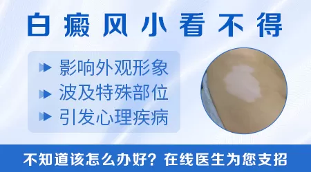 儿童正常白斑和白癜风的区别图片