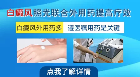 白癜风涂药还需要配合光疗吗