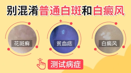 怎么分辨脸上的白斑是哪种病症