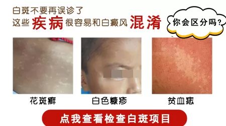 女性脖子锁骨处发白不痛不痒是白癜风吗