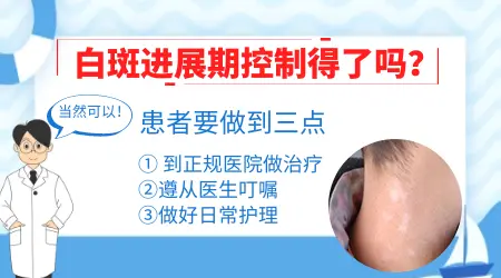 白癜风扩散一般多久停止