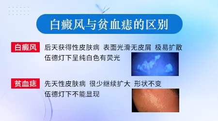 贫血痣和白癫风在症状上如何鉴别