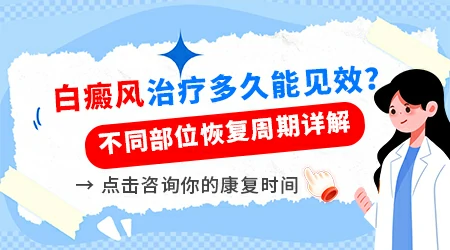 一般白癜风治疗多久白斑会开始变小