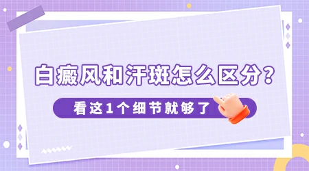 怎么区分身上的白是白癜风还是花斑癣