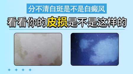 眼眉皮肤发白是什么原因引起的