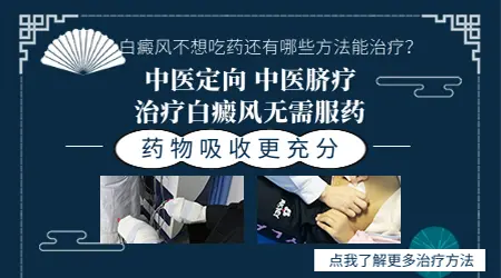 小孩白癜风用什么药能不能看好