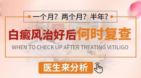 白斑多久做一次伍德灯检查比较合适
