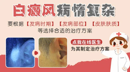 打针输液能治好白癜风吗