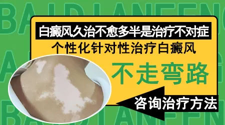 白癜风治疗期间白斑反而扩散了是怎么回事