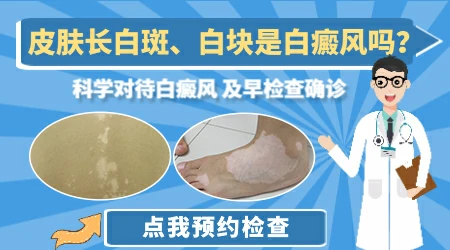 肛门周围有白斑是怎么回事